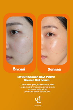 MYEON Somon DNA PDRN+ Bounce Ball Serum 30 ml – Çift Fazlı Cilt Gençleştirme